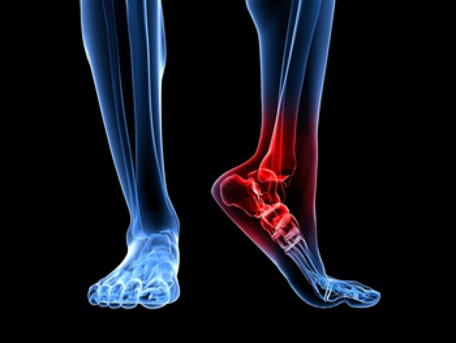 Why the heck is my heel sore in the morning? - The Physio Depot